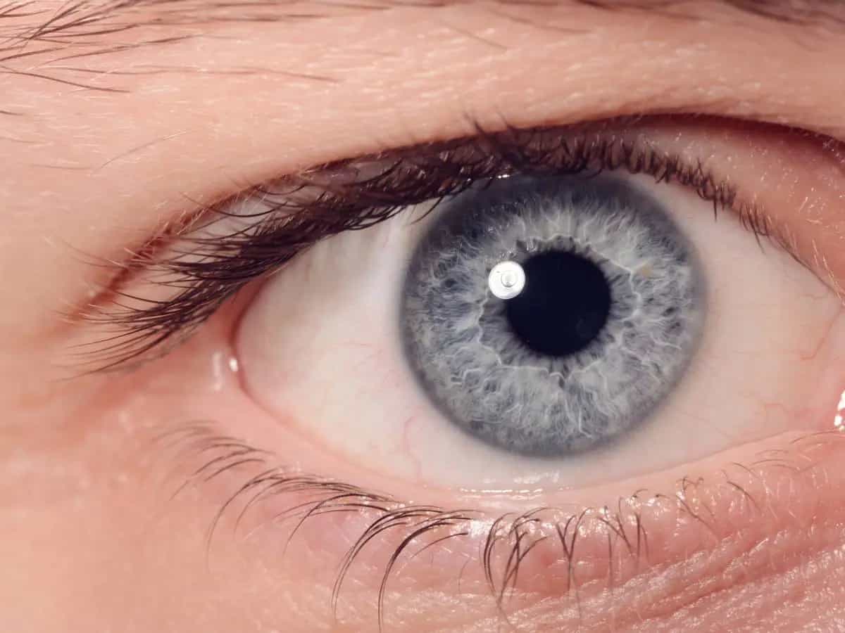 Secchezza oculare, ecco alcuni rimedi naturali